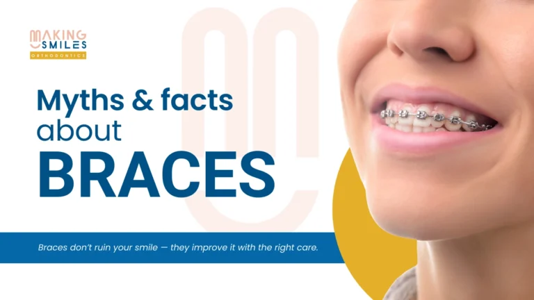 Braces Myths and Facts Explained | Making Smiles Orthodontics
