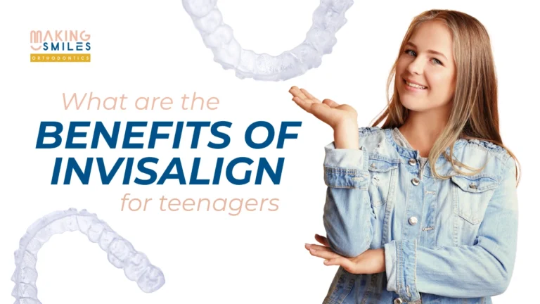 What Are the Benefits of Invisalign for Teenagers?