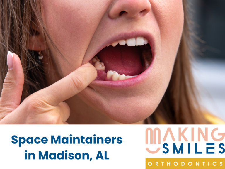 space maintainers by Making Smiles Orthodontics Madison AL